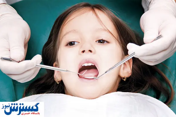 علل فاصله میان دندان ها چیست؟