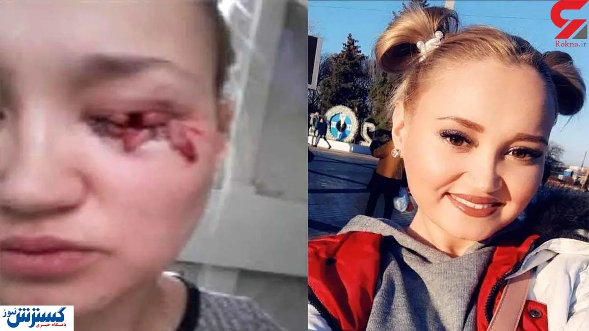 سگ ولگرد چشم و چال دختر زیبا را درآورد / فیلم +۱۶