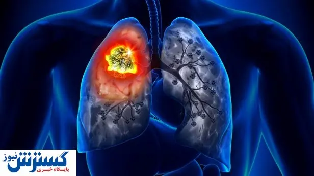 این شیفت کاری سرطان زاست