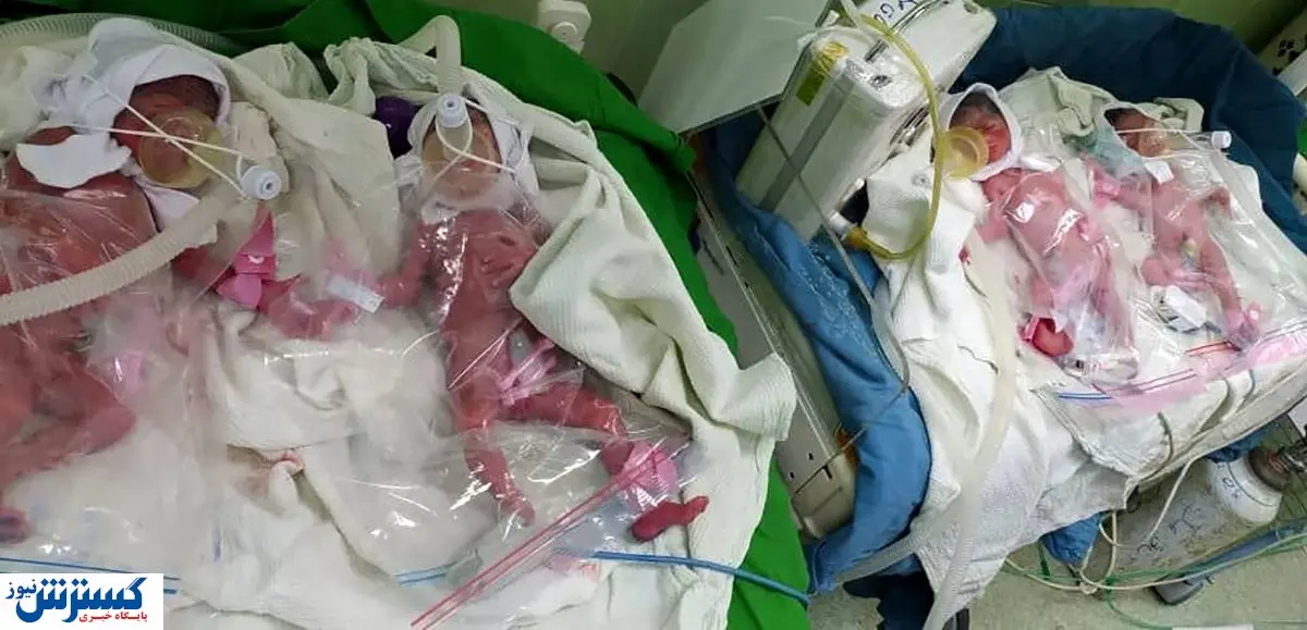 زن ۱۸ ساله چهارقلو به دنیا آورد+ عکس