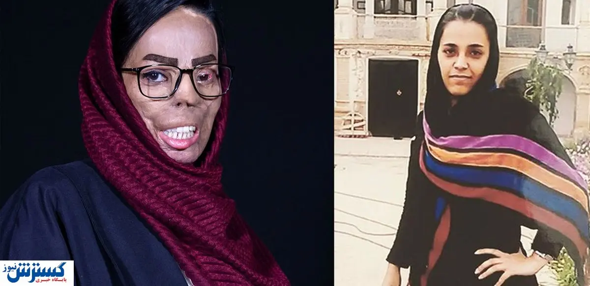 اسیدپاشی هولناک عروس به صورت خواهرشوهر+عکس