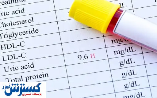 خوراکی‌های ممنوع در زمان اسید اوریک بالا