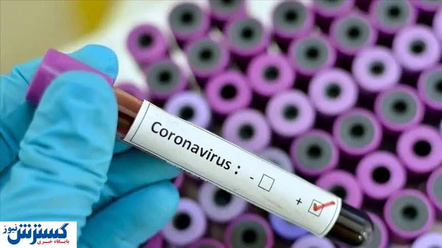 قیمت واکسن آنفلوآنزا چقدر است؟