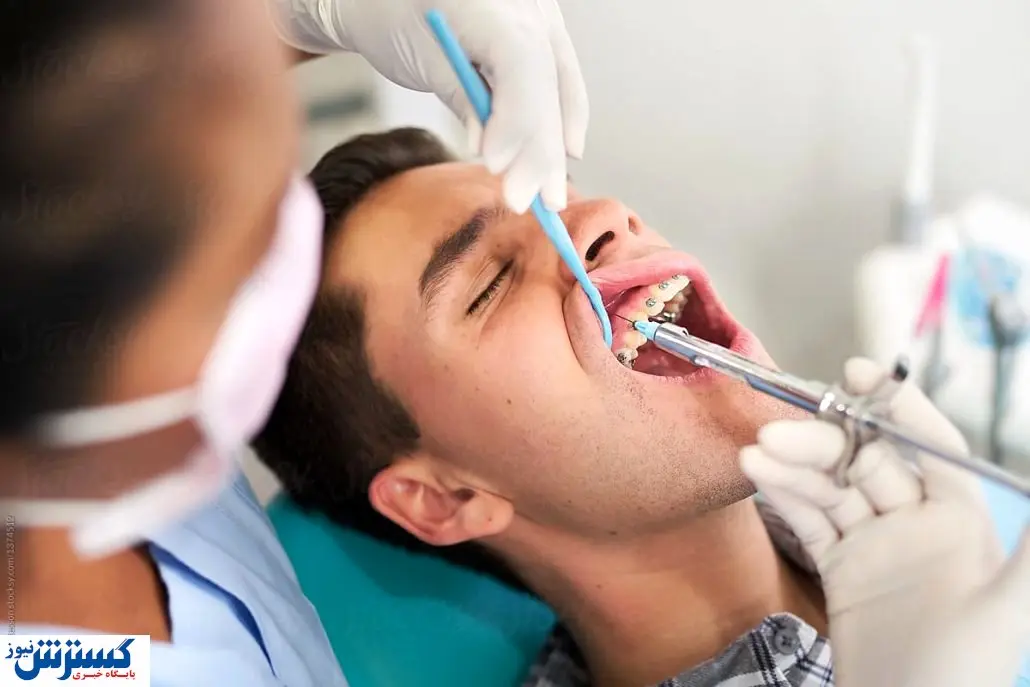 چرا پرکردن دندان دوام ندارد؟