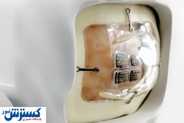 ساخت چشمی که هر نابینایی را بینا می‌ کند!