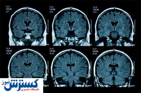 عوامل دستکاری گزارش های MRI دستگیر شدند!