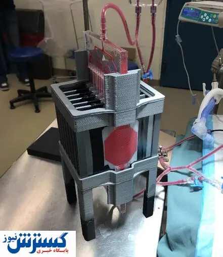 ابداع ریه مصنوعی برای تنفس نوزادان نارس