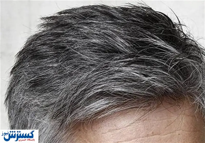 خداحافظی با ریزش موی سر با مصرف این دو مکمل غذایی