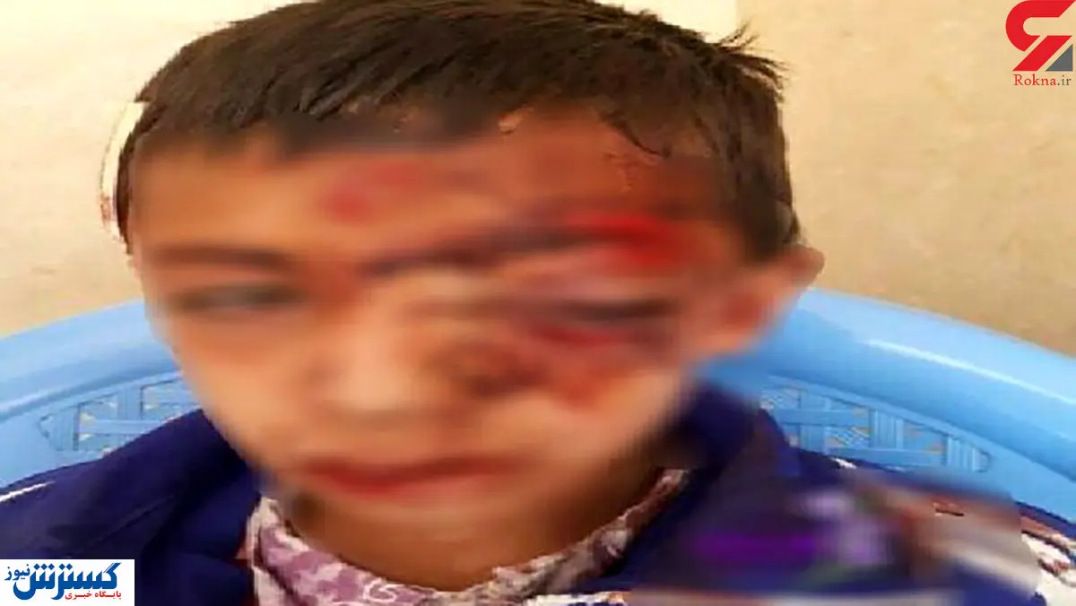 صدمه عجیب به دانش آموز به خاطر شرکت در کلاس آنلاین