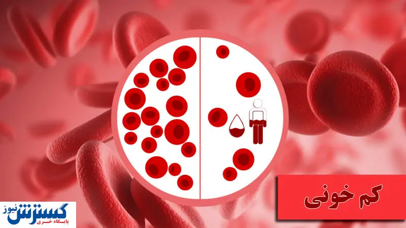 چطور بفهمیم کم خون هستیم؟