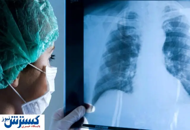 خبرهای ناامیدکننده از عوارض دائمی کرونا