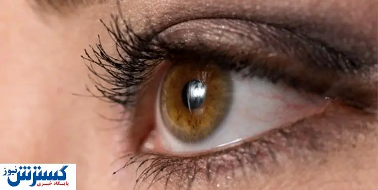 راه درمان  آبریزش «چشم» در بهار