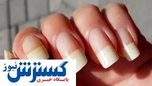 با این روش ها ناخن های محکم و سالم داشته باشید