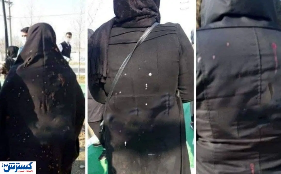 اسیدپاشی بر صورت زنان تمامی ندارد