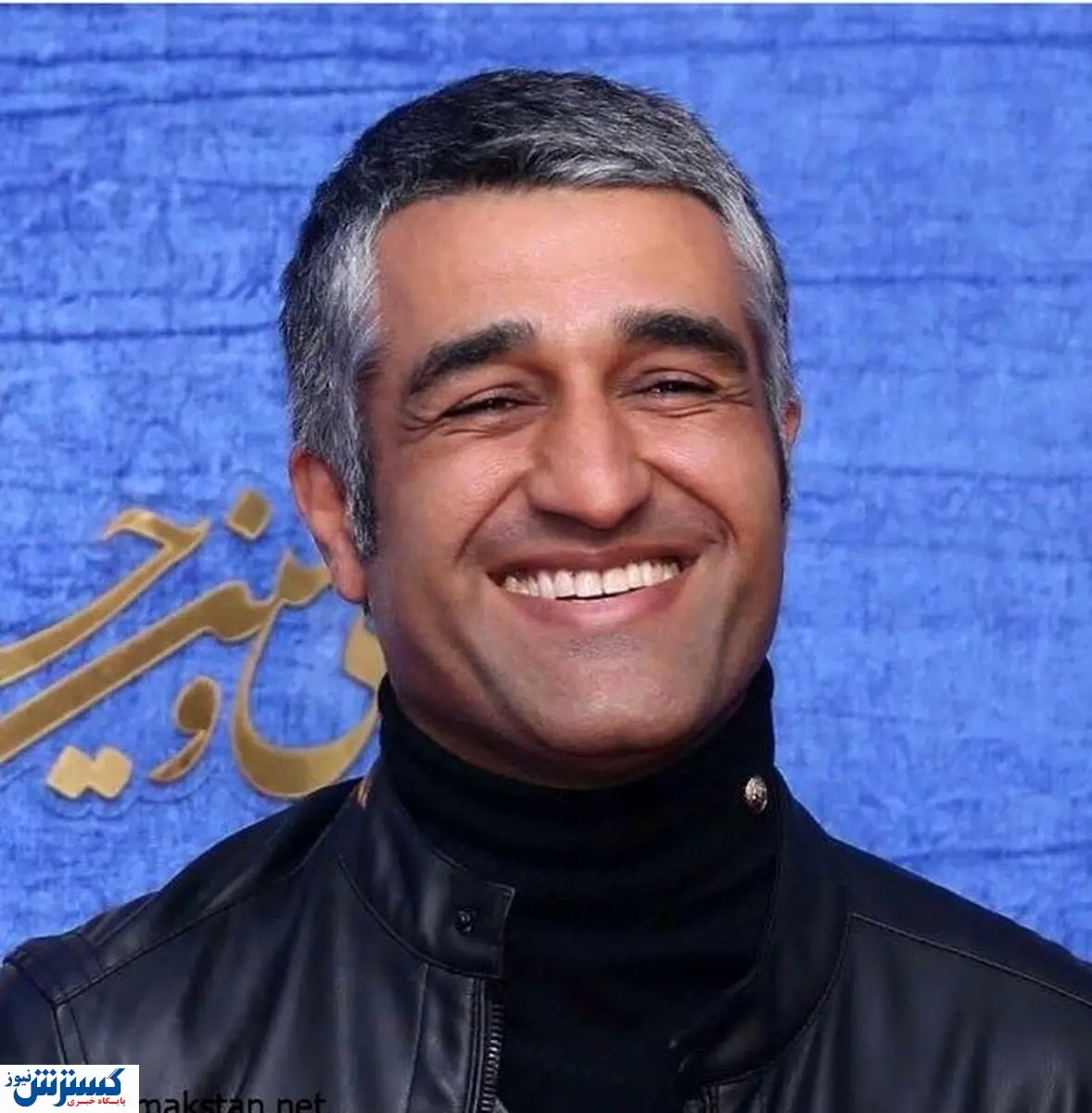 تغییر چهره پژمان جمشیدی+عکس