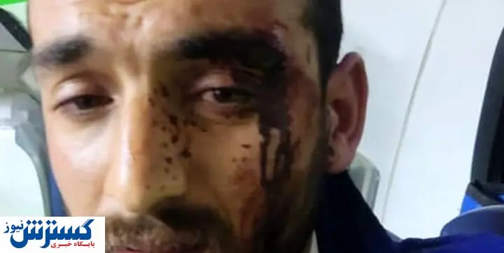 قمه کشی در درگیری با تکنسین های اروژانس + عکس