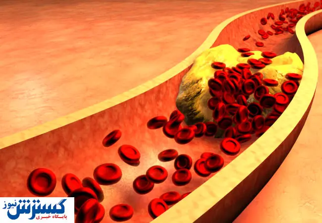 اگر تری گلیسرید بالا دارید این مواد غذایی را مصرف کنید