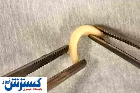 خبر خوش درباره ترمیم بینی