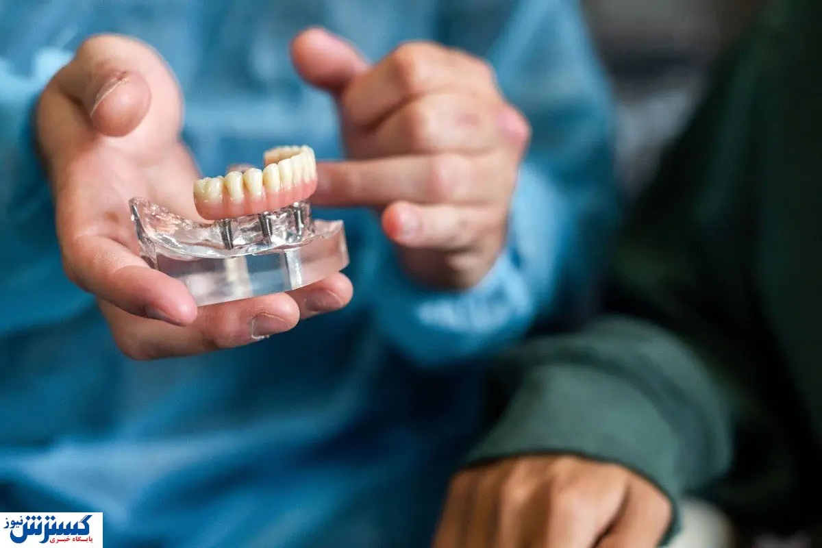ایمپلنت دندان قیمت