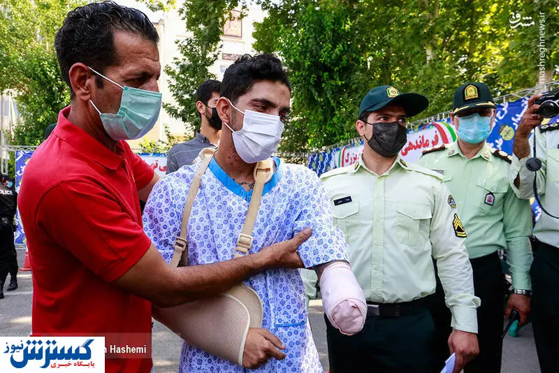 قطع کردن دست یک جوان توسط سارق ۱۸ ساله! + عکس