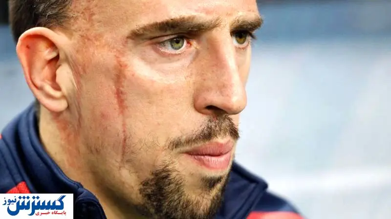 ۲ بمب نقل وانتقالاتی در آستانه انفجار