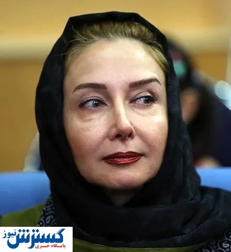 گرانترین عمل زیبایی کتایون ریاحی / + عکس