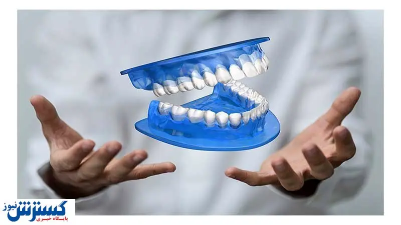گزینههای درمانی پروتزهای دندانی