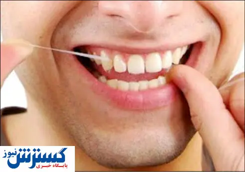 چند روش عالی برای سفید شدن دندان ها