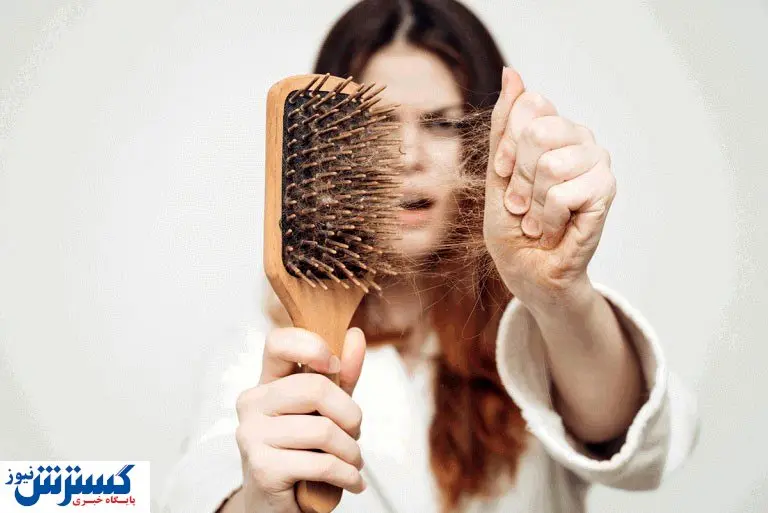 راه های درمان ریزش مو