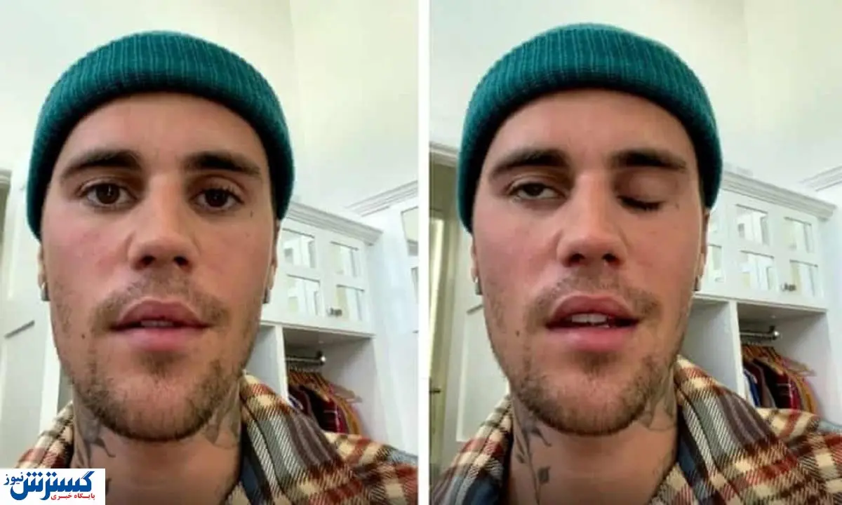 این بیماری جاستین بیبر را فلج کرد!