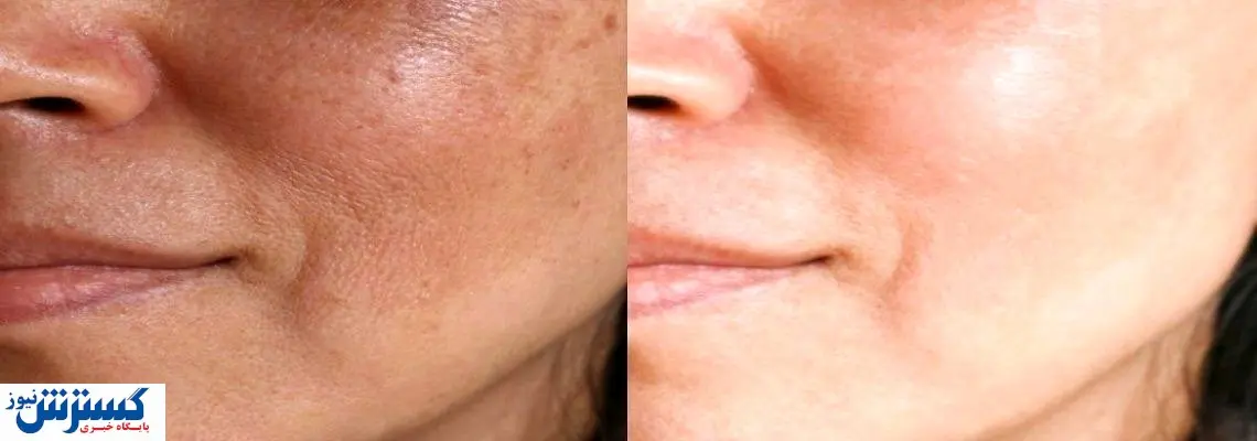 چگونه بهترین دکتر پوست را پیدا کنیم؟