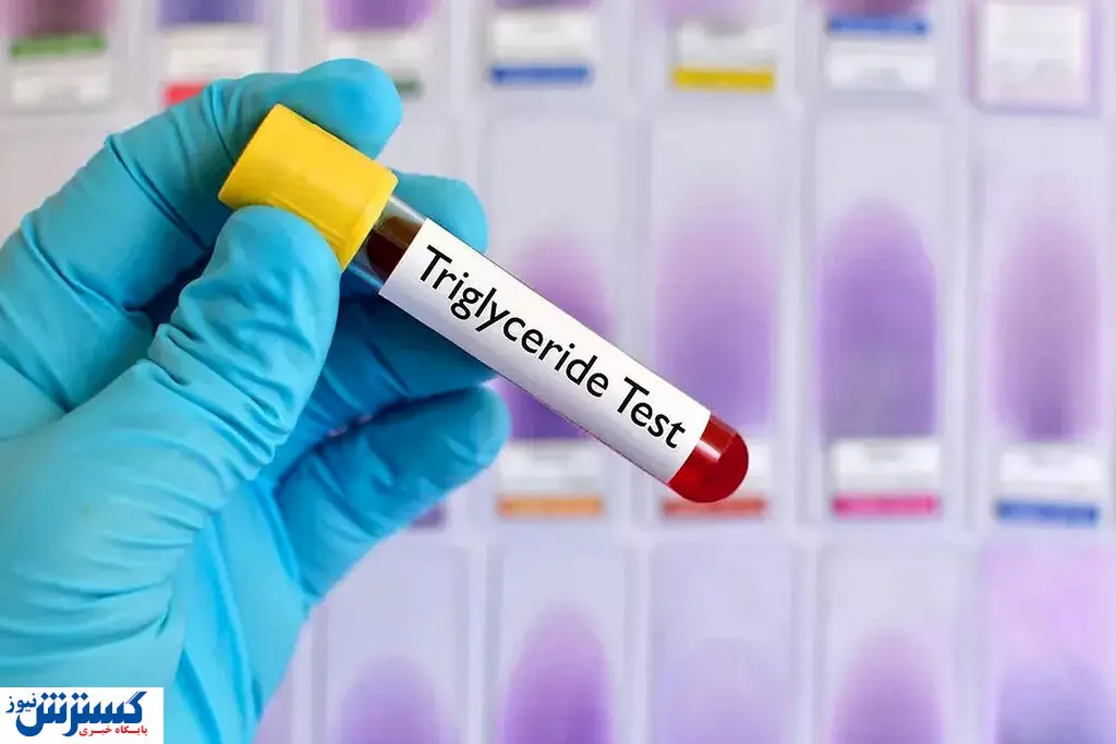 راهکار های مهم کاهش چربی خون / این غذا ها تاثیر بالایی دارد