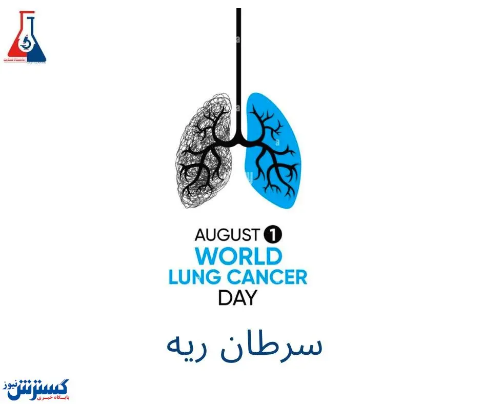 سرطان ریه/شناخت تا درمان
