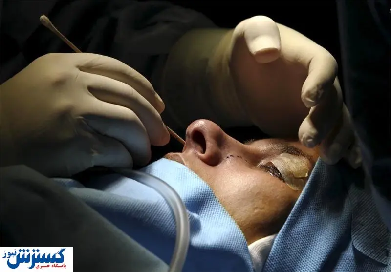 هجوم متخصصان به کار زیبایی