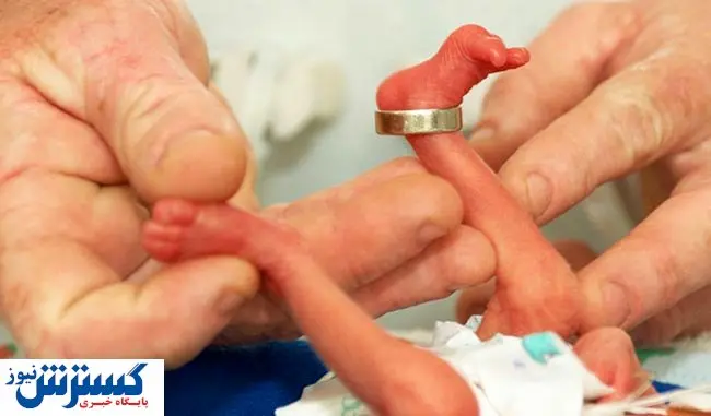 سلامت روان پدر موثر در زایمان زودرس