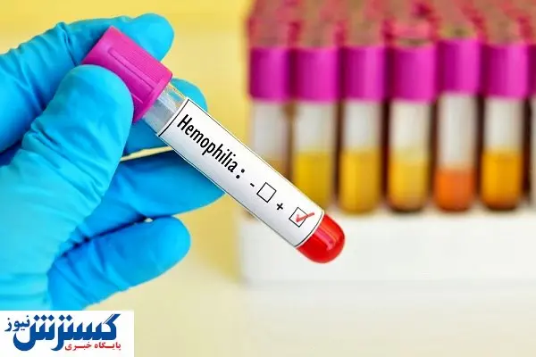 ثبت ۱۳ هزار مبتلا به هموفیلی در ایران