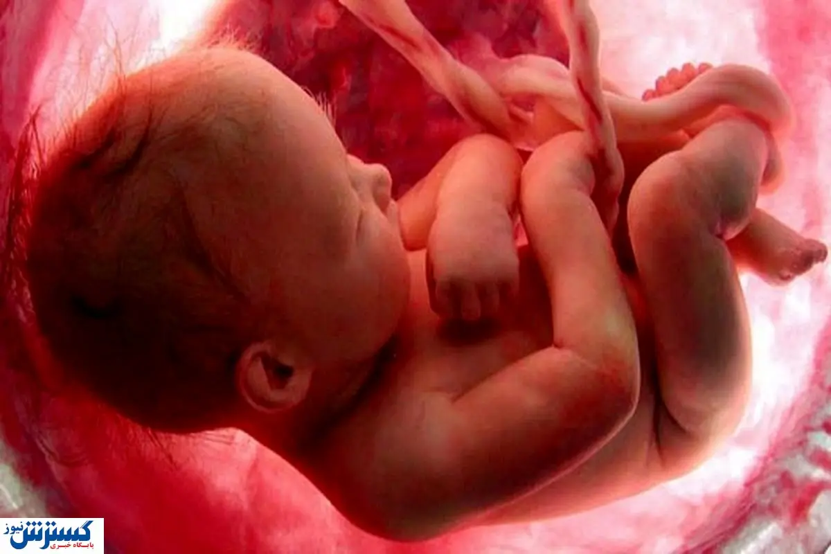 کیت های غربالگری نوزاد لاکچری شد / وزارت بهداشت کوتاه نیامد؟