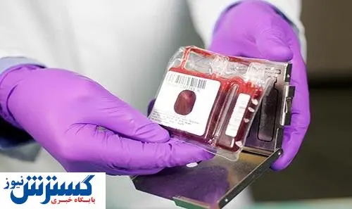 ۲۰۰ هزار نمونه خون بند ناف ذخیره در بانک خون