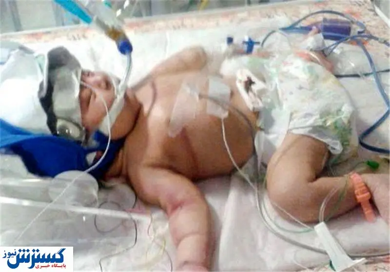 فوت تاسف برانگیز جنجالی نوزاد در بیمارستان نهاوند