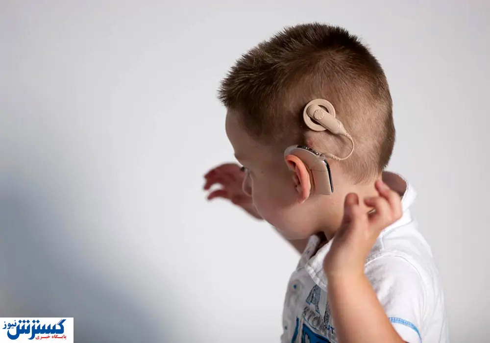 شرایط کاشت حلزون شنوایی  رایگان