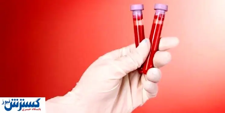 اگر غلظت خون دارید عمرتان طولانی خواهد بود