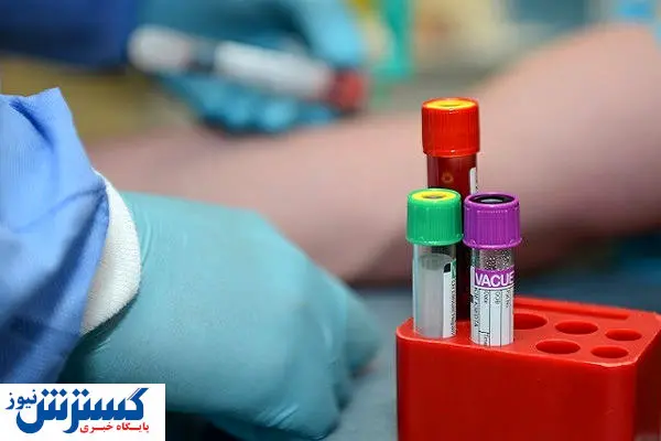 غربالگری این افراد رایگان شد