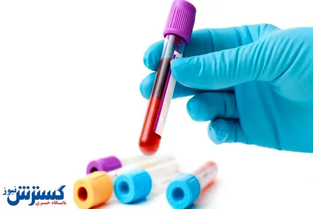 شناسایی یک گروه خونی جدید در ایران!