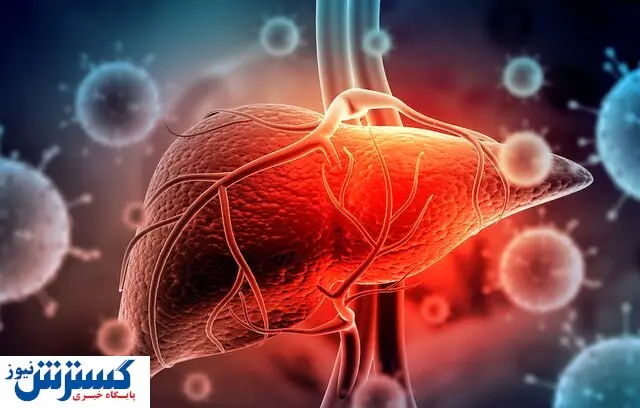 ۴۰ درصد مردم مبتلا به کبد چرب هستند و نمیدانند