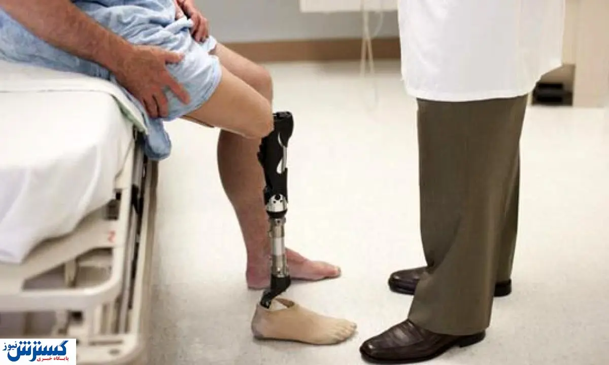 صندوق بیماران صعب العلاج افراد قطع عضو را تحت پوشش بیمه بیماران خاص پذیرفت