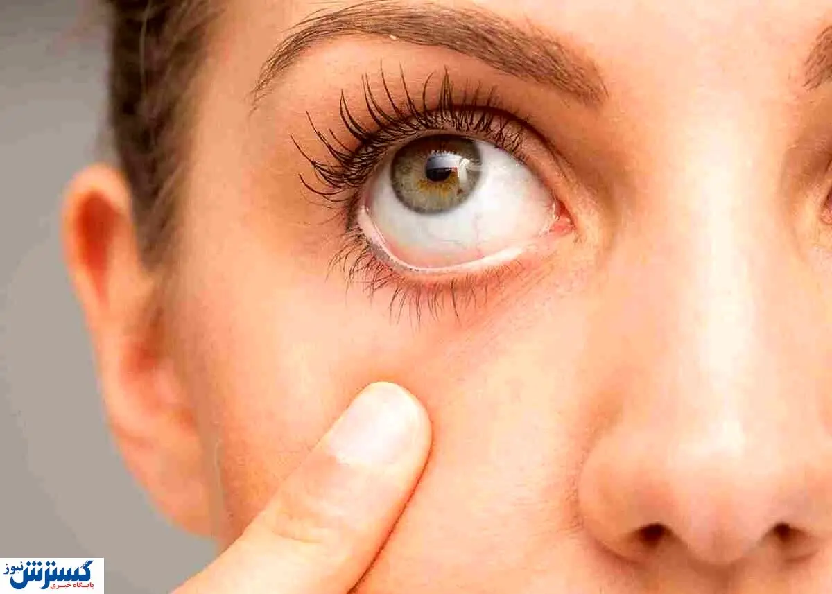 خنده بر این درد واقعا دوا است!