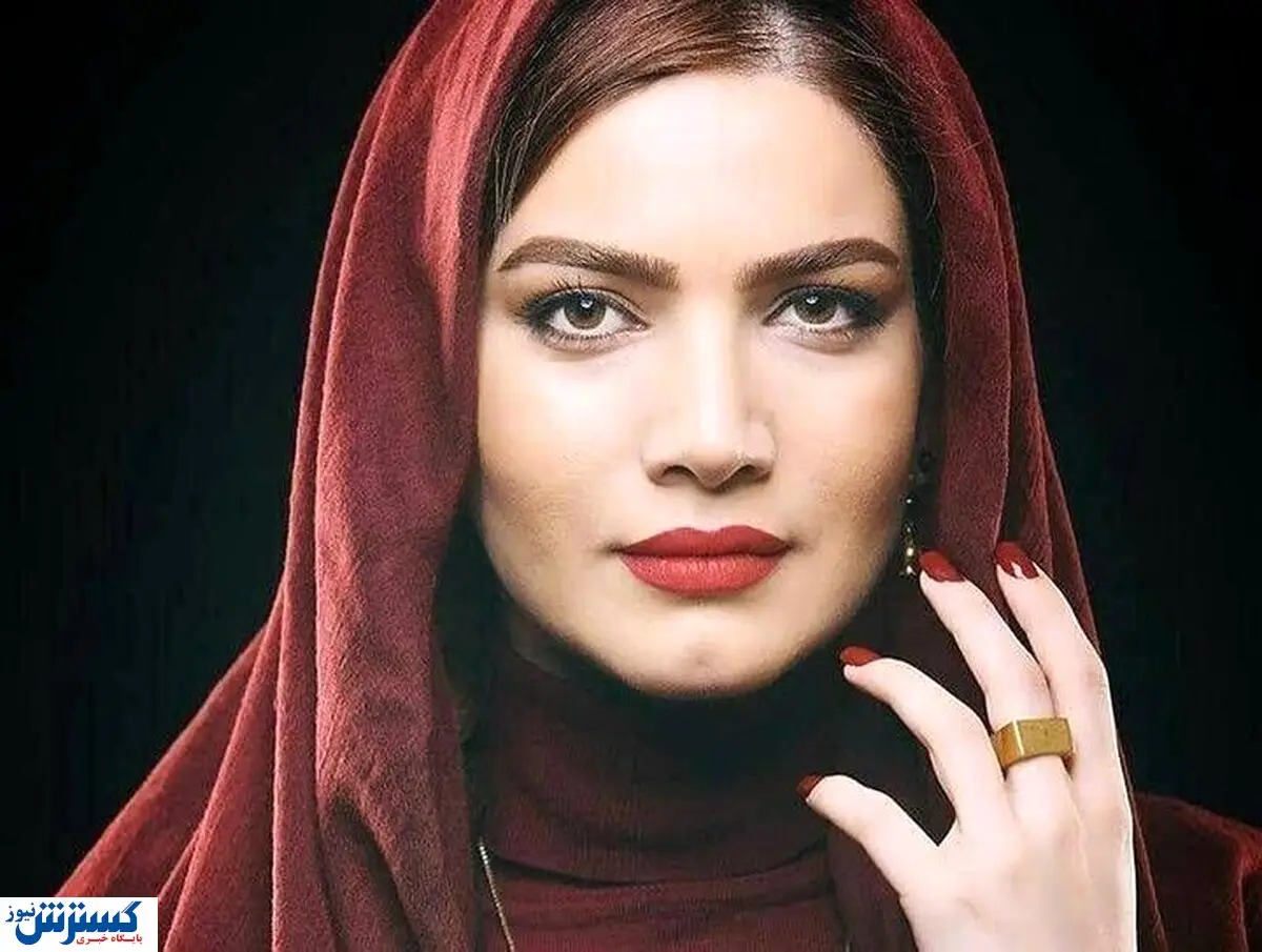 تغییر چهره جذاب خانم طناز سینما و تلویزیون | عمل زیبایی چهره او را زمین تا آسمان تغییر داد! +عکس