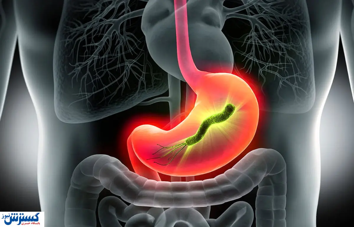 شیوع بیماری ناشناخته گوارشی در کشور | این علائم را جدی بگیرید