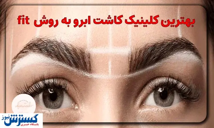 بهترین کلینیک‌های کاشت ابرو به روش FIT در تهران