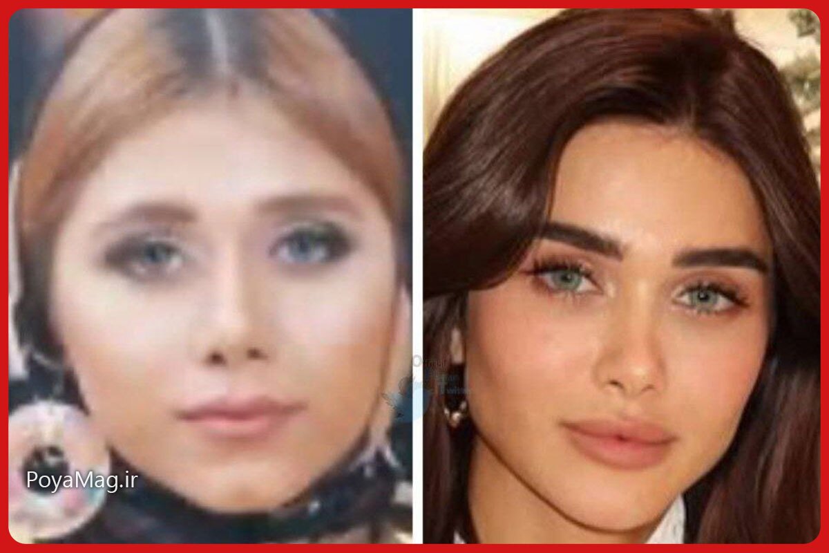 هیوا امین ، مدل ایرانی زیباترین چهره ۲۰۲۵ خاورمیانه شد | عکس قبل از عمل